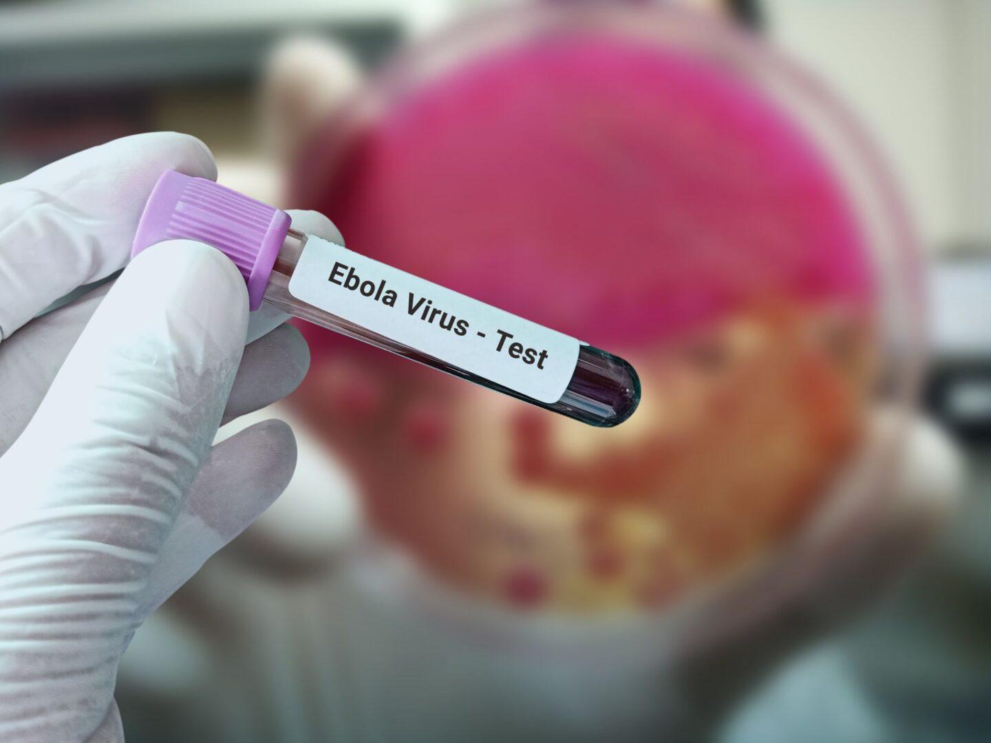 Test na obecność wirusa Eboli
