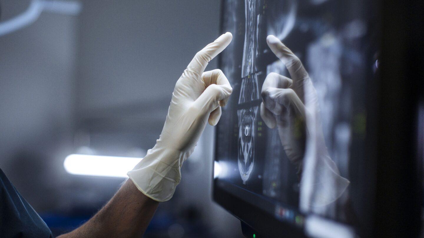 Lekarz w rękawiczkach ochronnych analizuje obraz radiologiczny na monitorze dotykowym. Fot. Getty Images