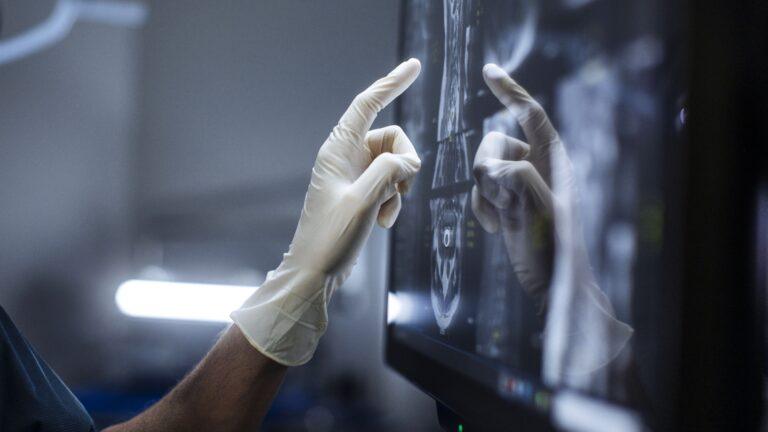 Lekarz w rękawiczkach ochronnych analizuje obraz radiologiczny na monitorze dotykowym. Fot. Getty Images